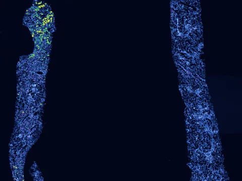 Human kidney preview
