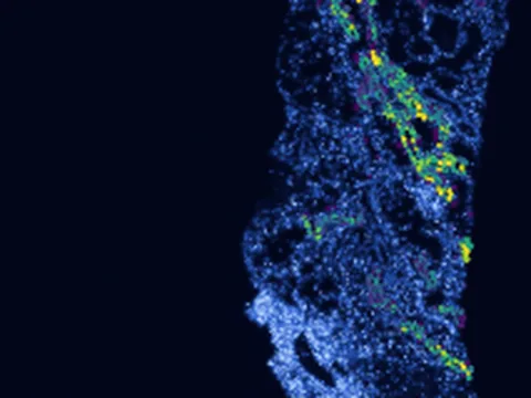 Human kidney preview