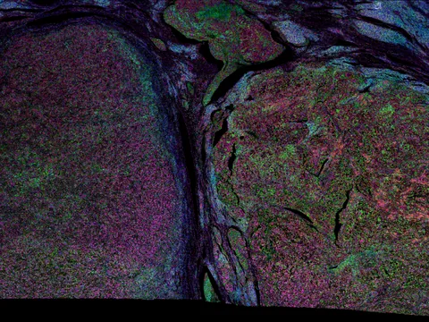 Human kidney preview