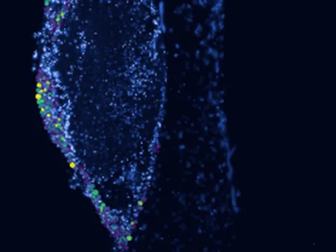 Human larynx preview