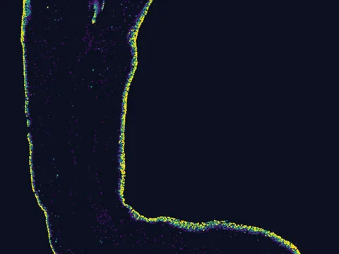 Ambystoma mexicanum limb preview