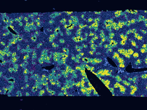 Mouse liver preview