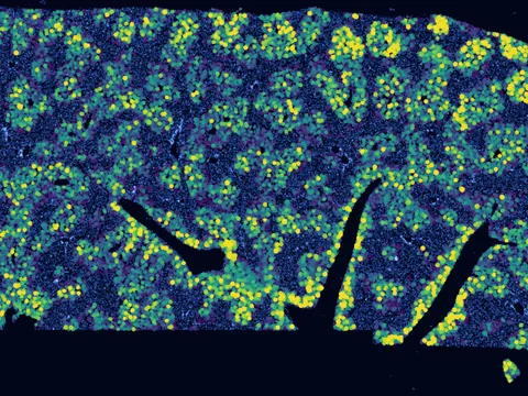 Mouse liver preview