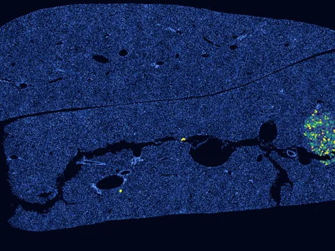 Mouse liver preview