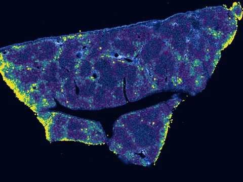 Human liver preview