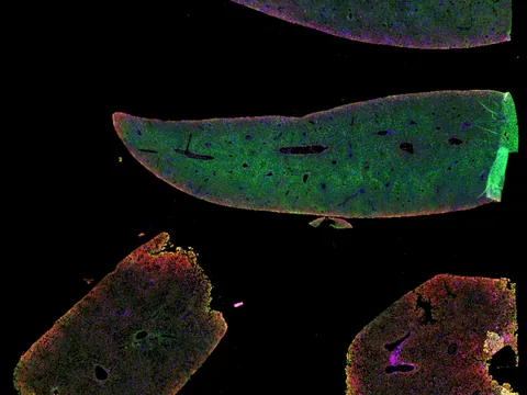 Mouse liver preview