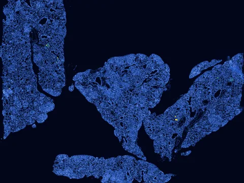 Mouse lung preview