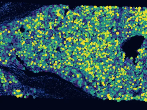Human lung preview