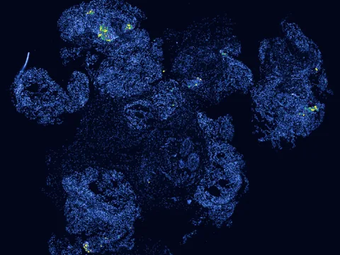 Human lung preview