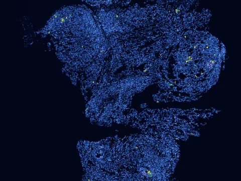 Human lung preview
