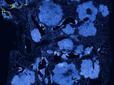 Mouse lung preview
