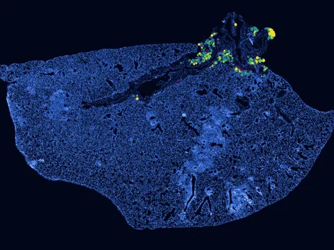 Mouse lung preview