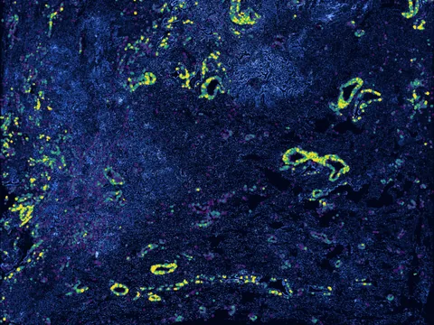 Human lung preview