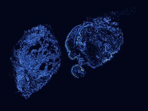 Human lung preview