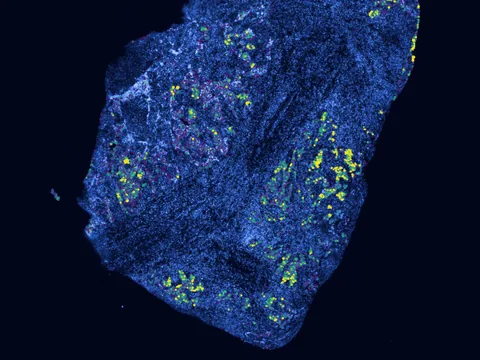 Human lung preview