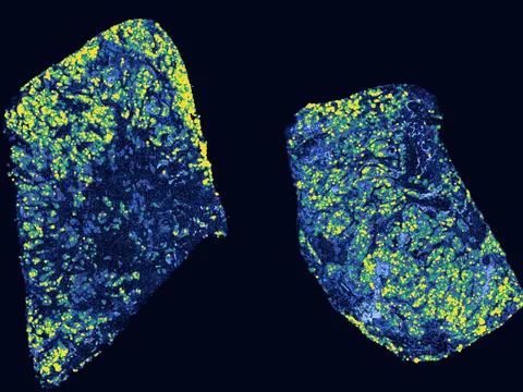 Human lung preview