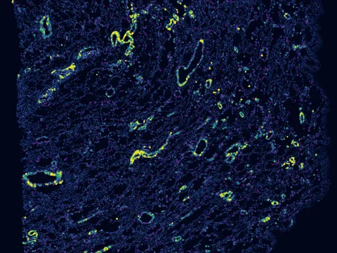 Human lung preview