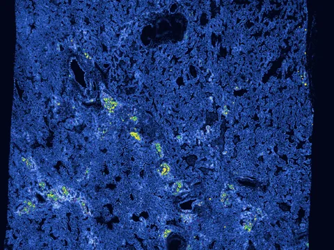 Human lung preview