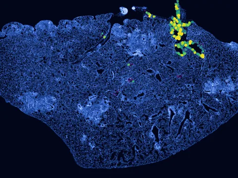 Mouse lung preview