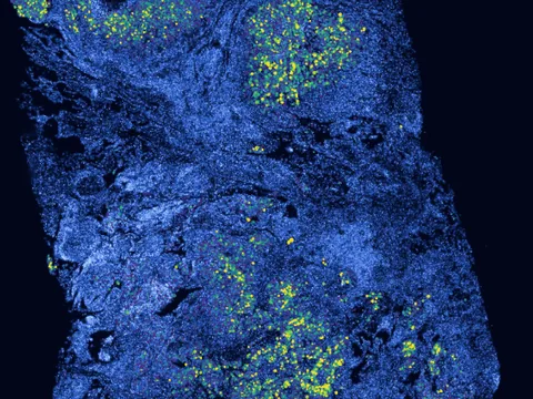 Human lung preview