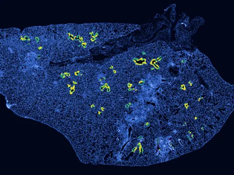 Mouse lung preview