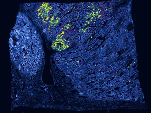 Human lung preview