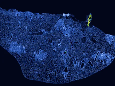 Mouse lung preview