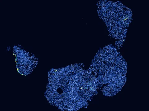 Human lung preview