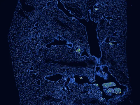 Mouse lung preview