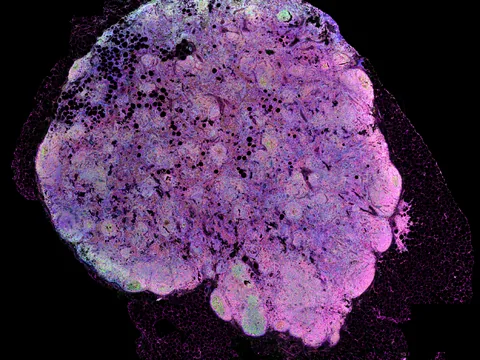 Human lymph node preview