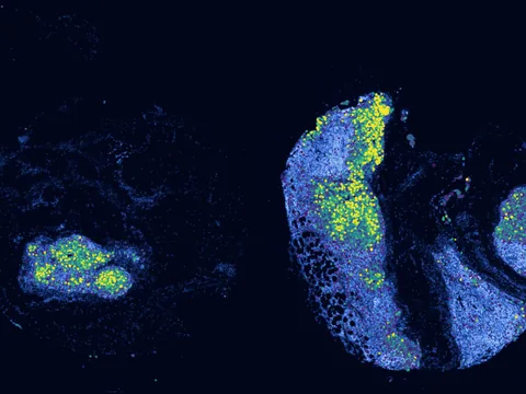Human lymph node preview
