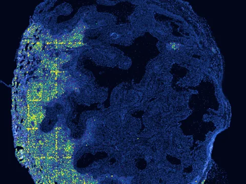 Human lymph node preview