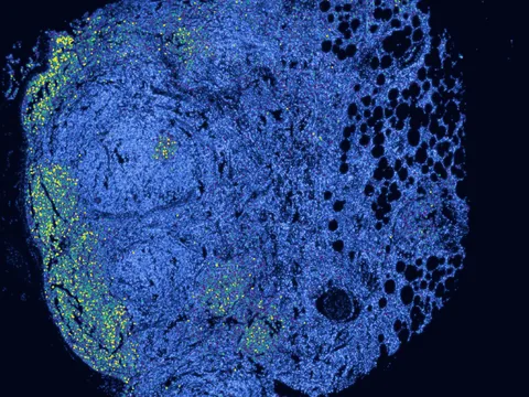Human lymph node preview