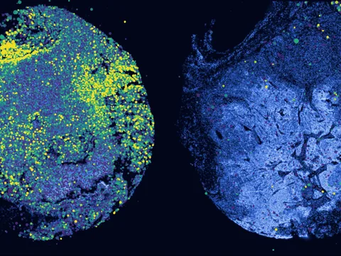 Human lymph node preview