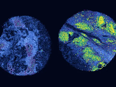 Human lymph node preview