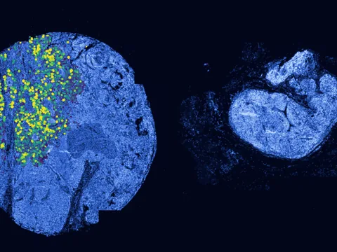 Human lymph node preview