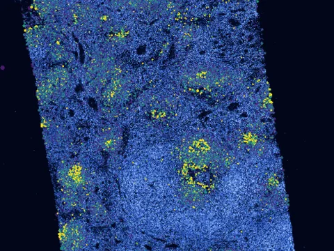 Human lymph node preview