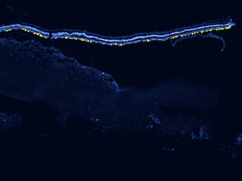 Human macula lutea preview