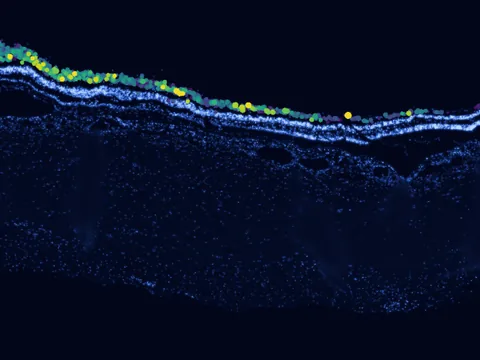 Human macula lutea preview