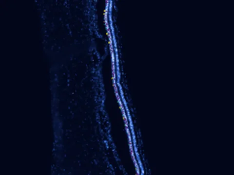 Human macula lutea preview