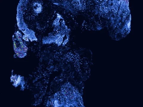 Human oropharynx preview