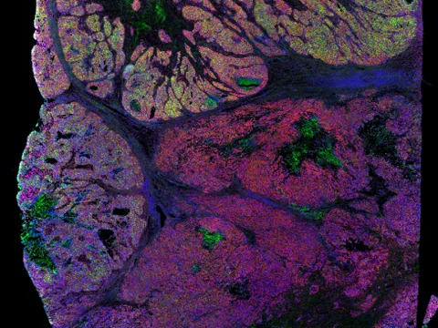 Human ovary preview