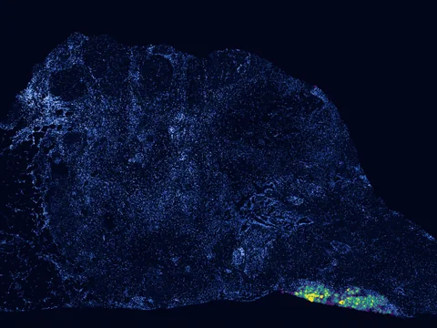 Human pancreas preview