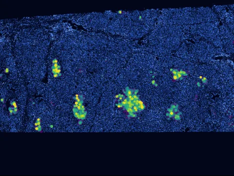 Human pancreas preview