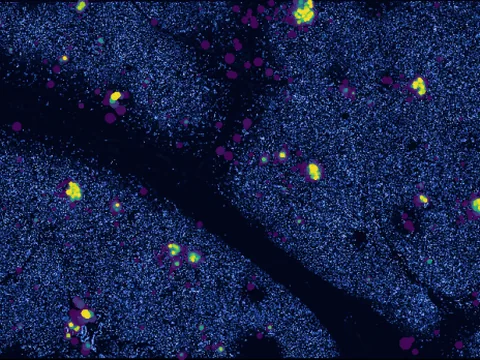 Human pancreas preview
