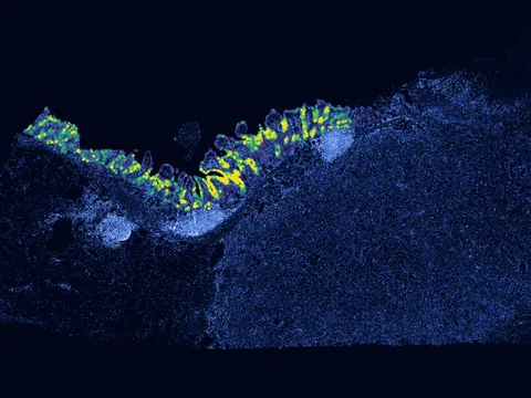 Human pancreas preview