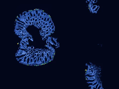 Human rectum preview