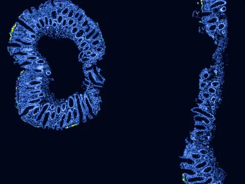 Human rectum preview