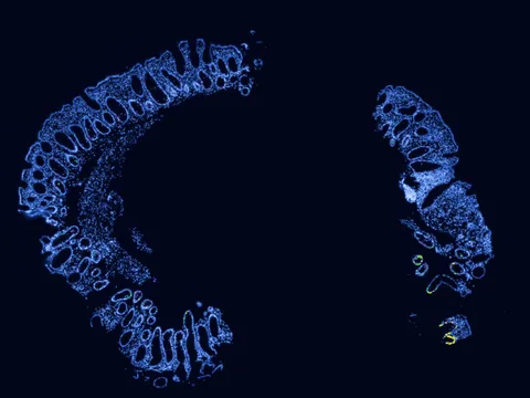 Human rectum preview