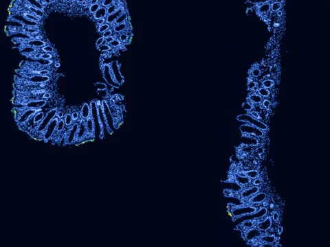 Human rectum preview